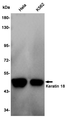Cytokeratin 18 Rabbit pAb