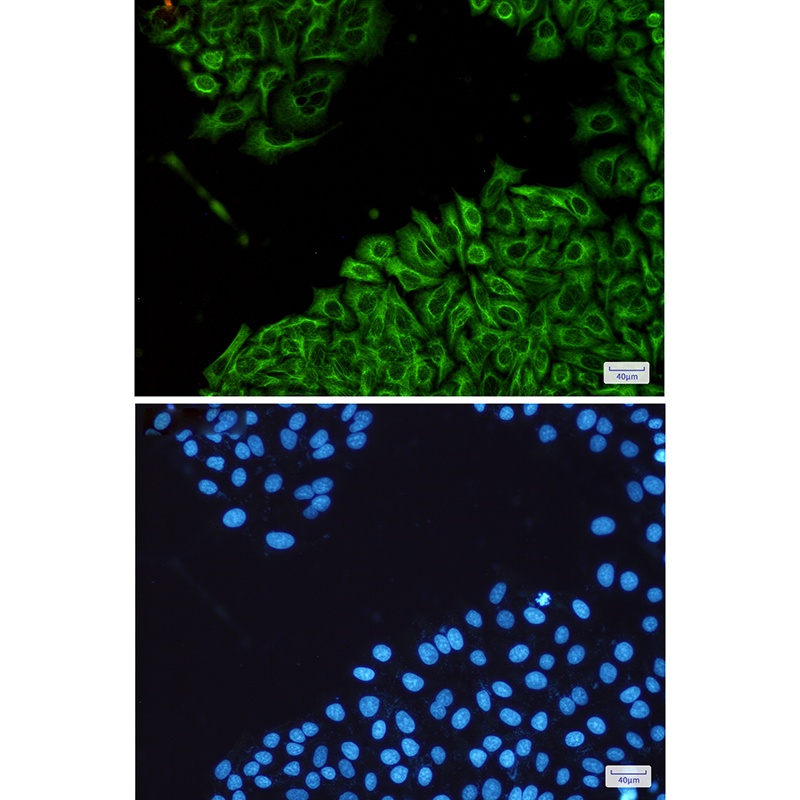 Cytokeratin 18 Rabbit pAb