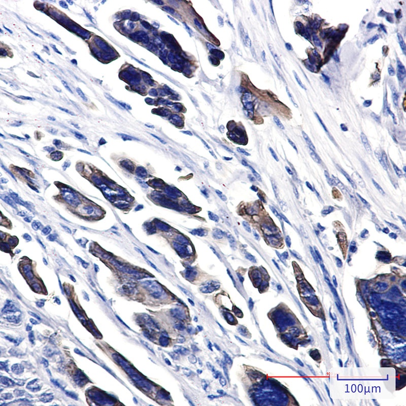 Cytokeratin 18 Rabbit pAb