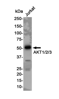 AKT Rabbit pAb