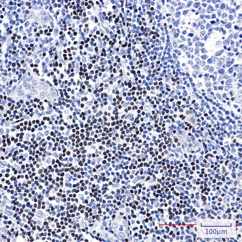 LEF1 Antibody