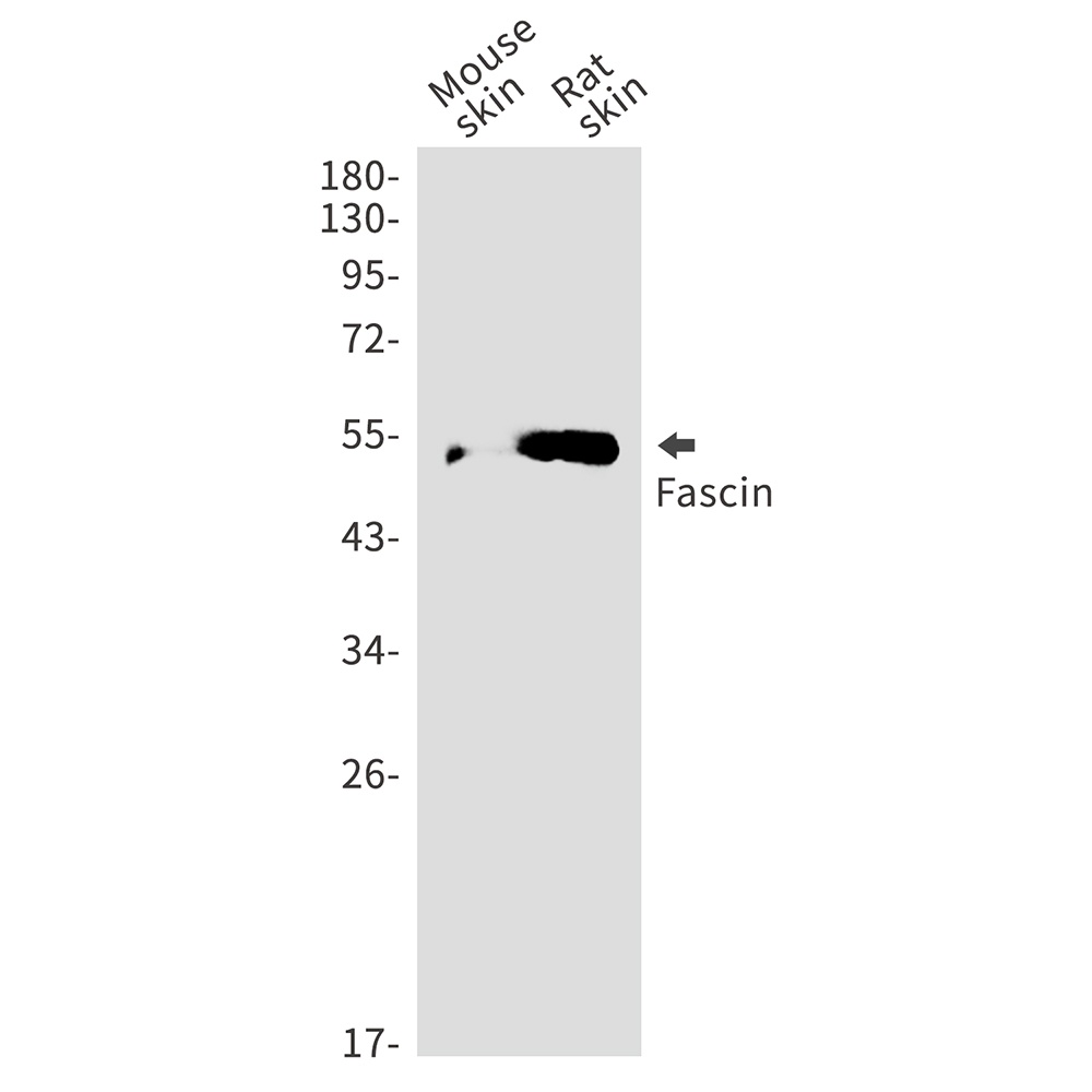 Fascin Rabbit pAb