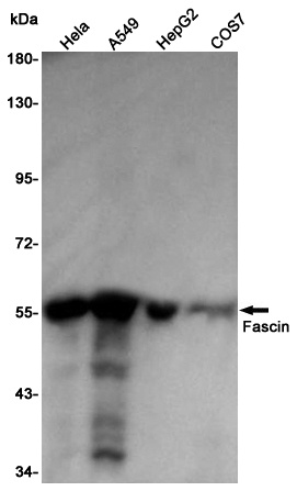 Fascin Rabbit pAb