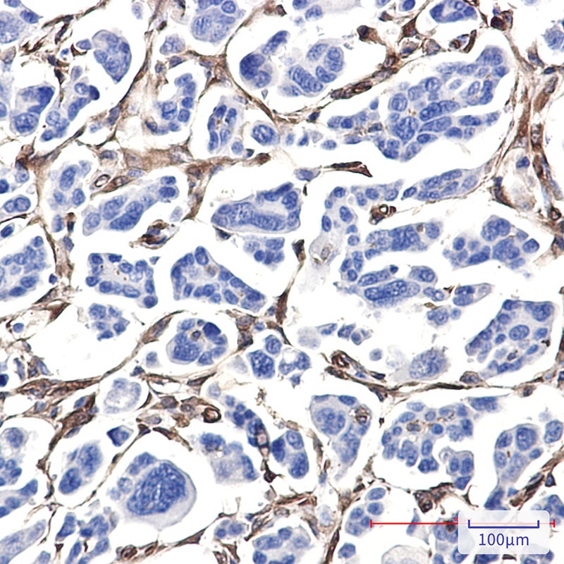 FSCN1 Antibody