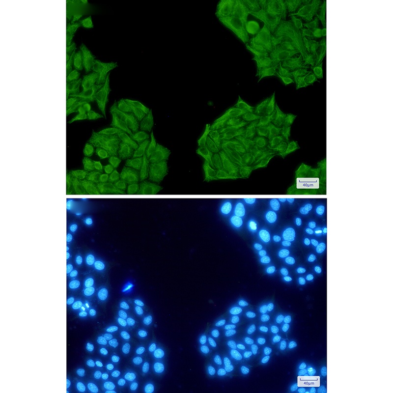 Cytokeratin 8 Rabbit pAb