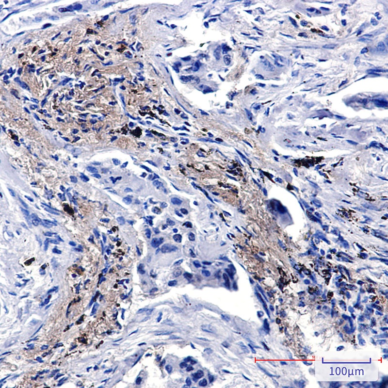 Lysozyme Rabbit pAb