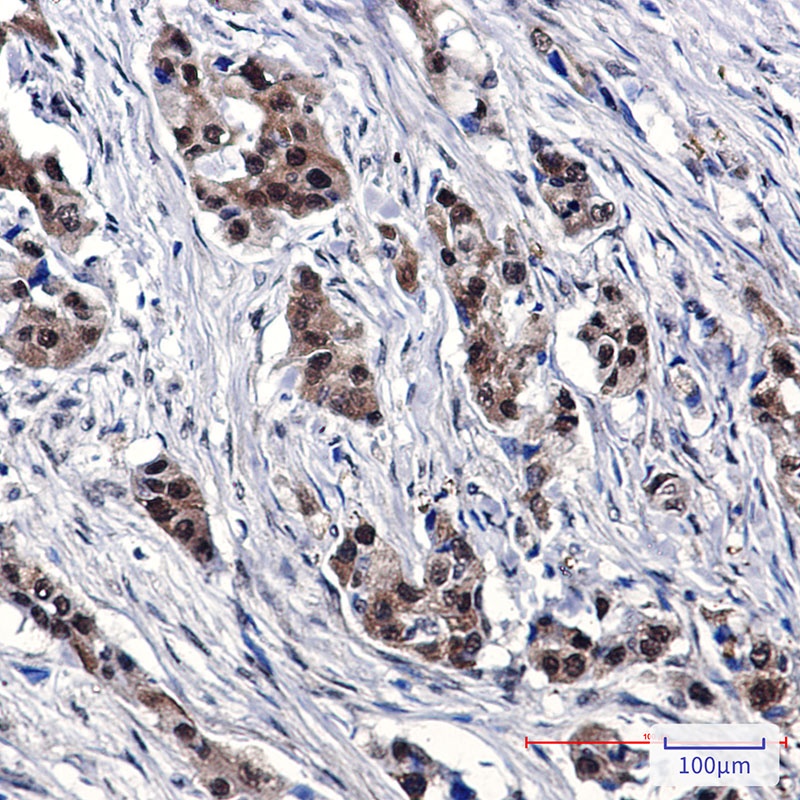 SUMO1 Antibody