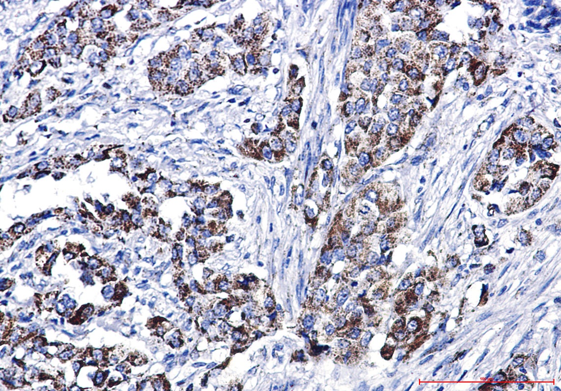 Glutaminase Rabbit pAb