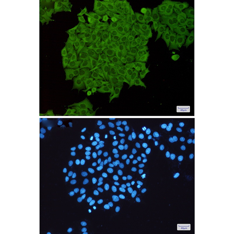 RHOA/RHOB/RHOC Antibody