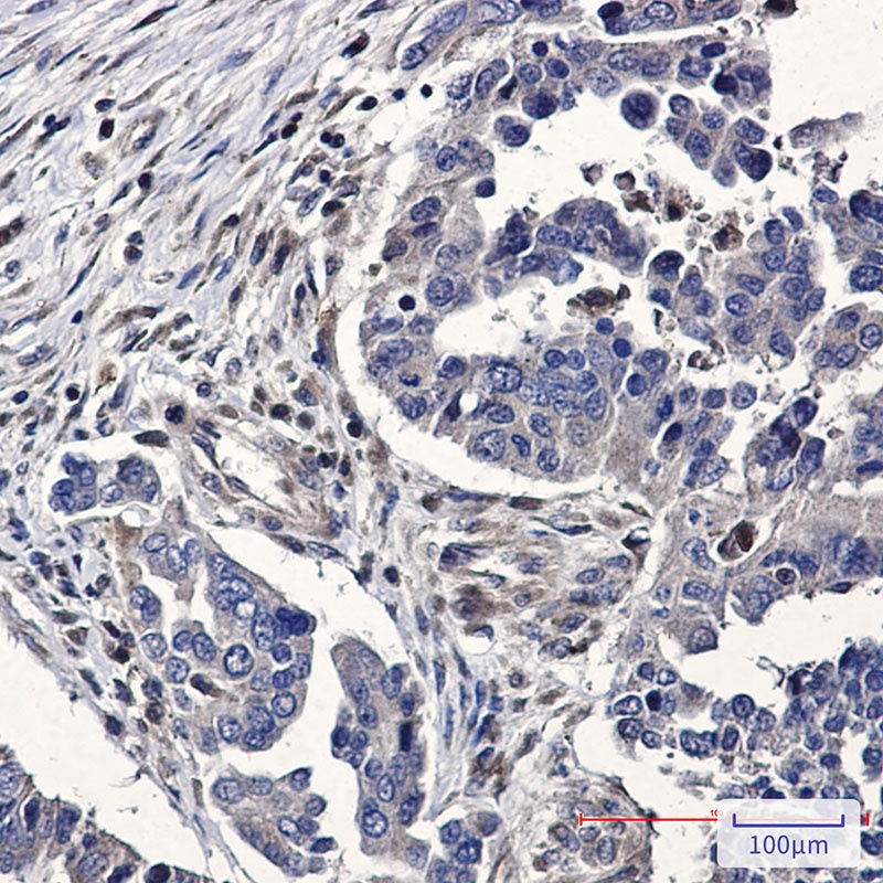 RHOA/RHOB/RHOC Antibody