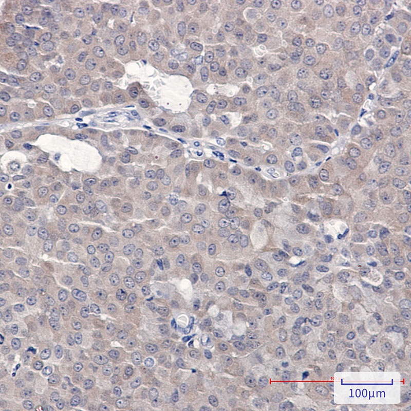 4E BP1 Rabbit pAb