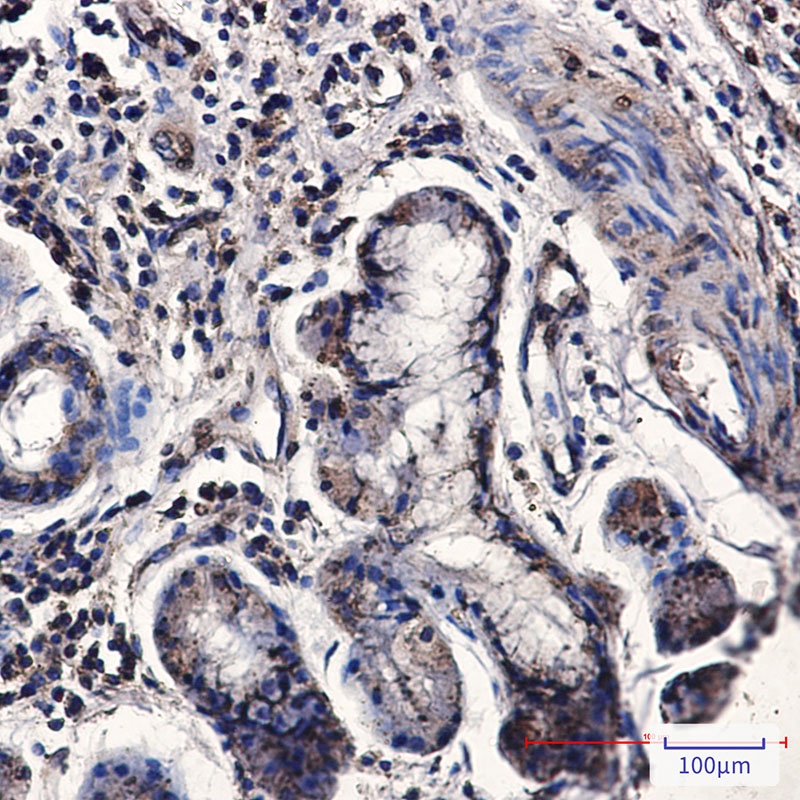 Cnot7 Antibody