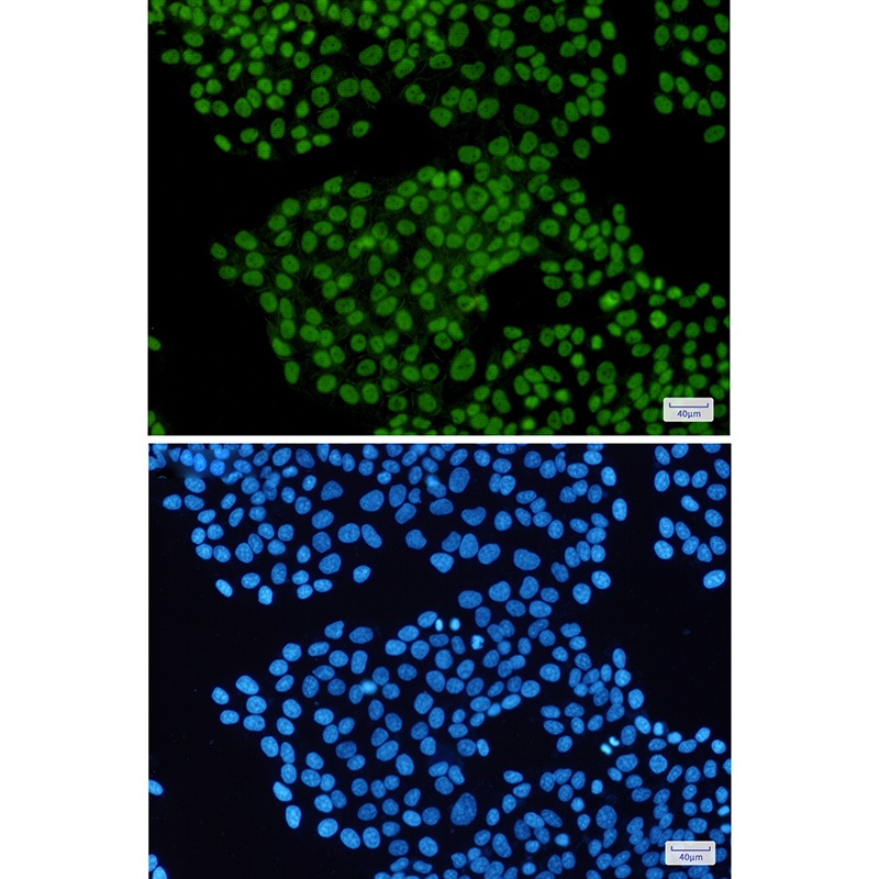 STAG2 Antibody