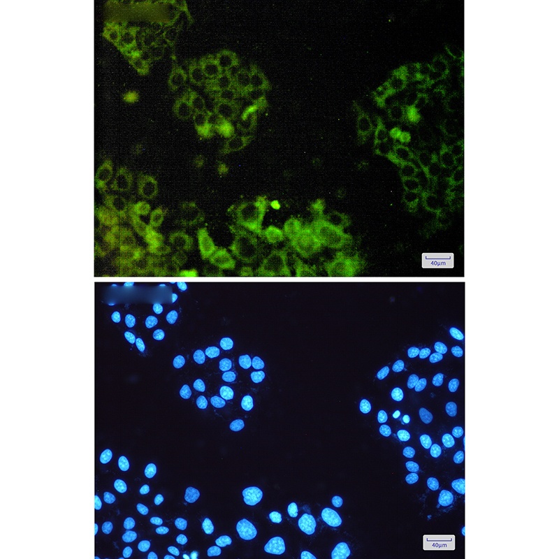 ATP6V1E1 Rabbit pAb