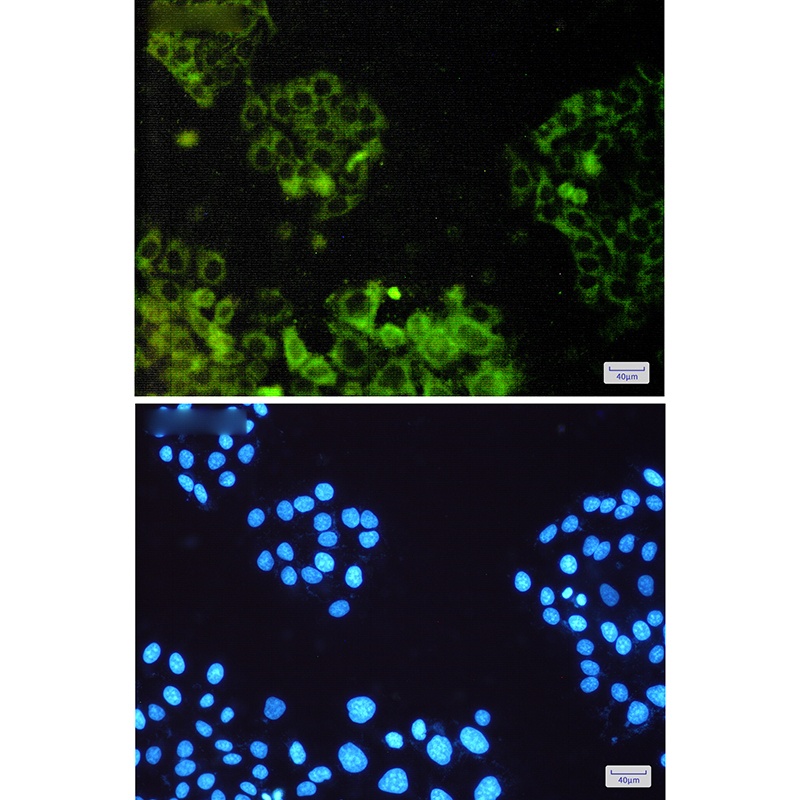 ATP6V1E1 Antibody