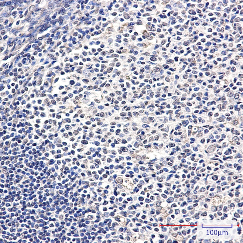 ATP6V1E1 Rabbit pAb