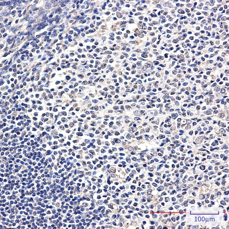 ATP6V1E1 Antibody