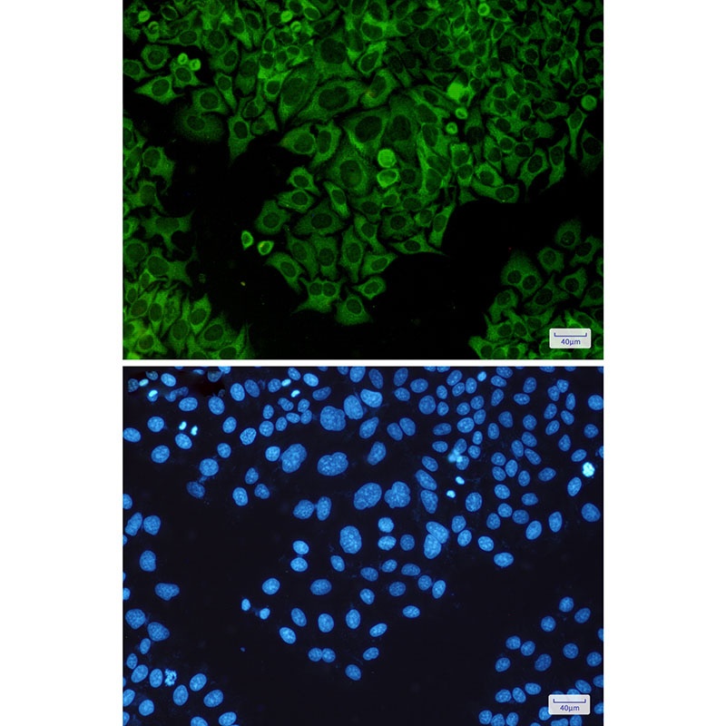 TNF Receptor 2 Rabbit pAb