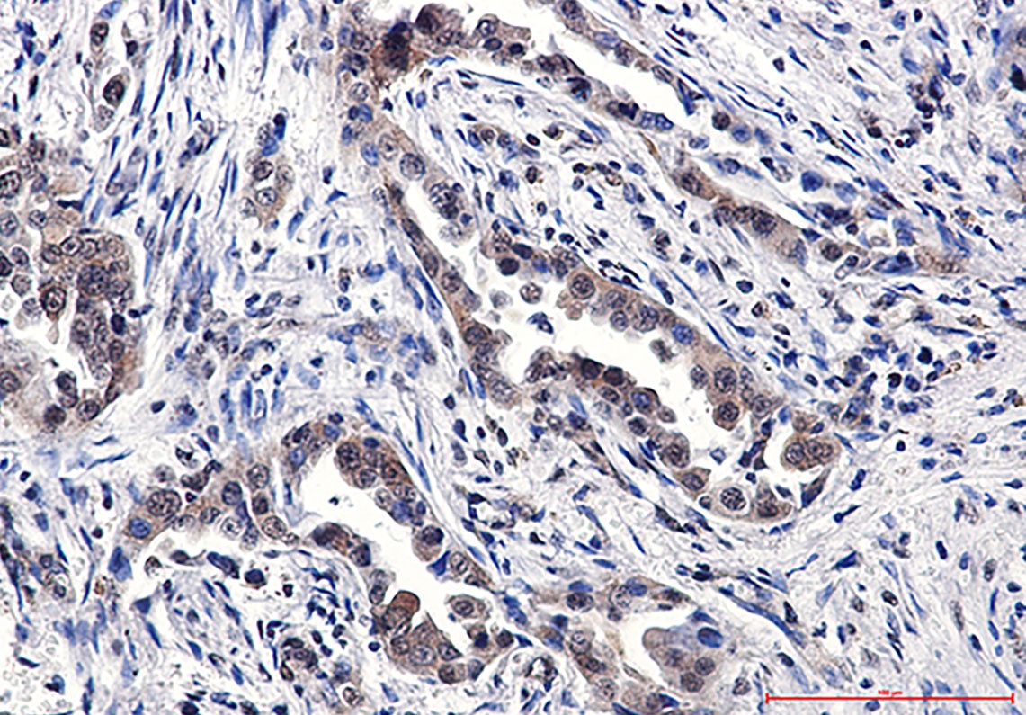 TNF Receptor 2 Rabbit pAb