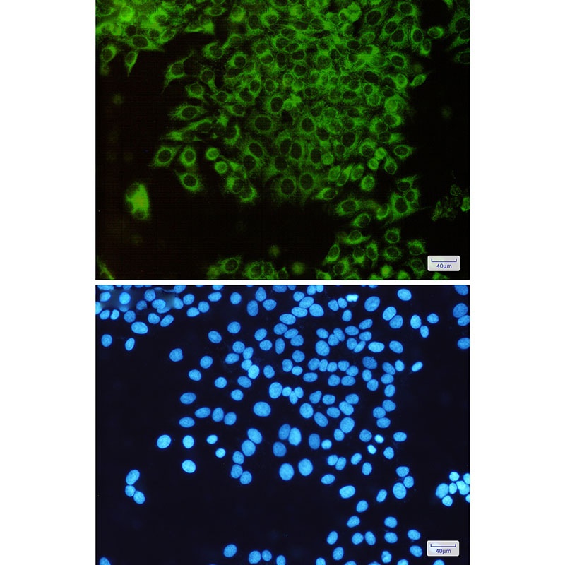 TOMM20 Antibody