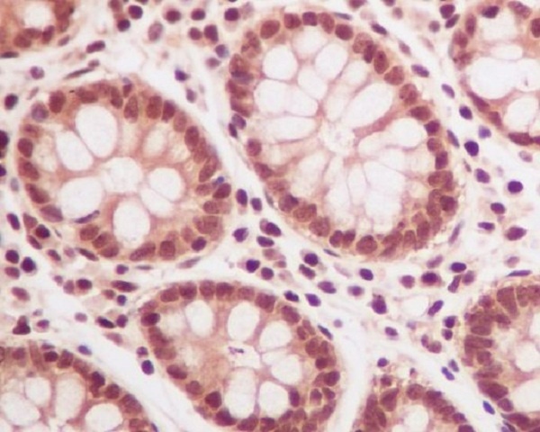 Ubiquitin Rabbit pAb