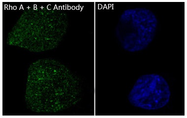 RHOA/RHOB/RHOC Antibody