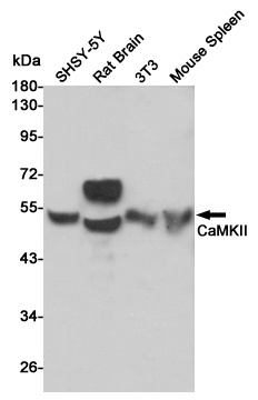 CAMK2B Antibody