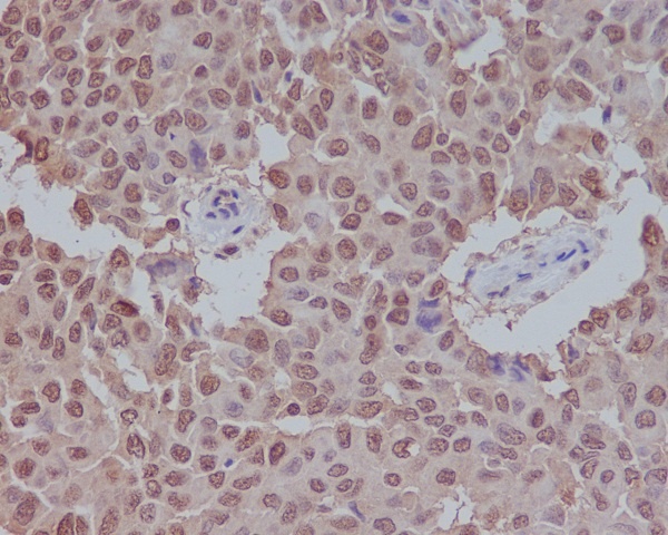 SUMO1 Rabbit pAb