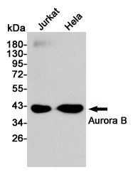 Aurora B Rabbit pAb