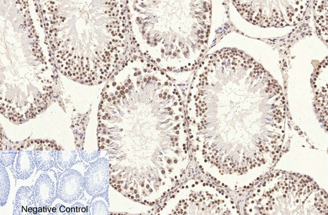 Histone H3 (6G2) Mouse mAb