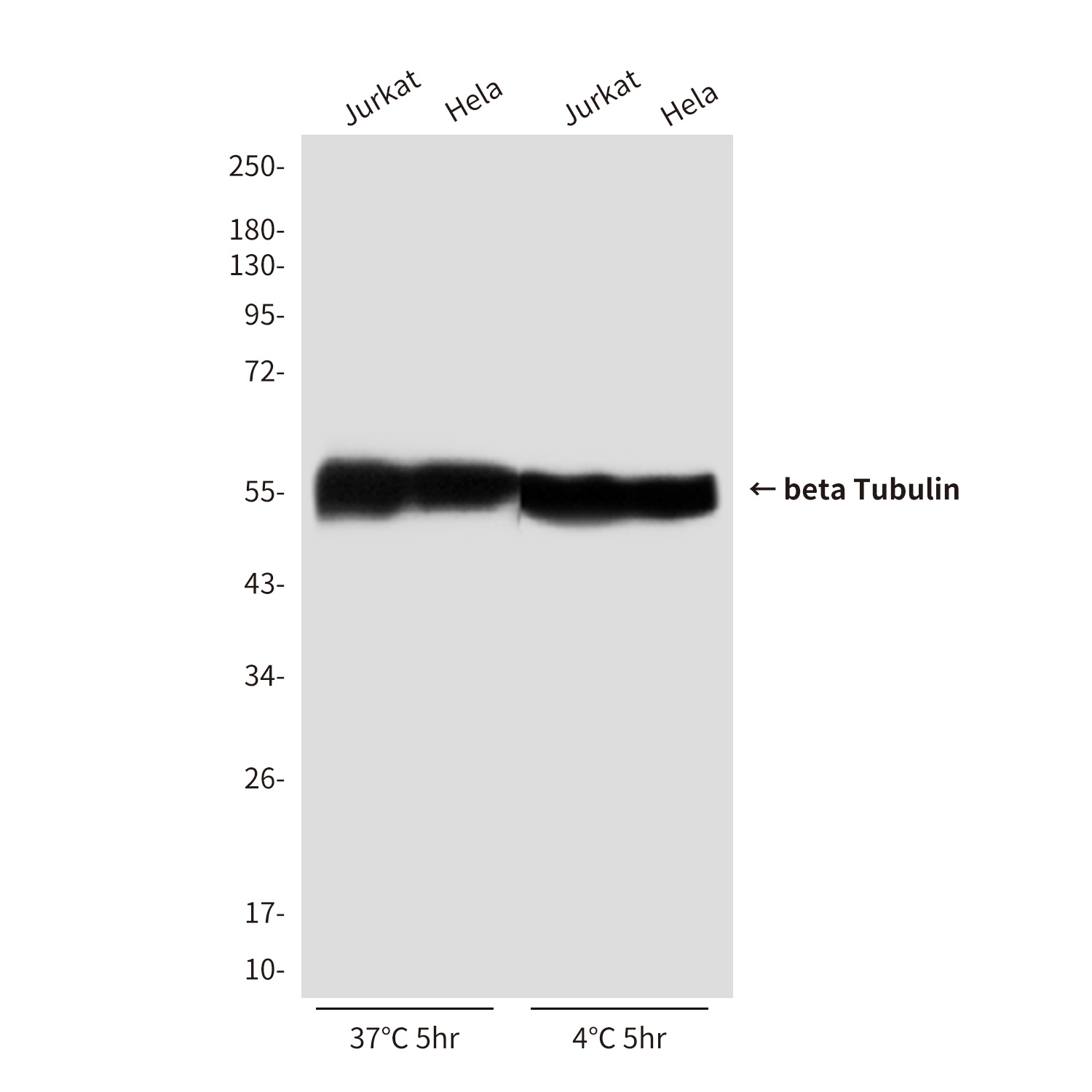 beta Tubulin (1E1) Mouse mAb