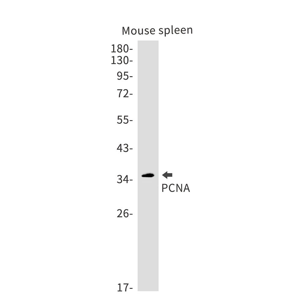 PCNA Rabbit mAb
