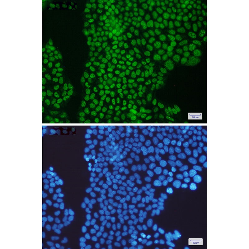 PCNA Rabbit mAb