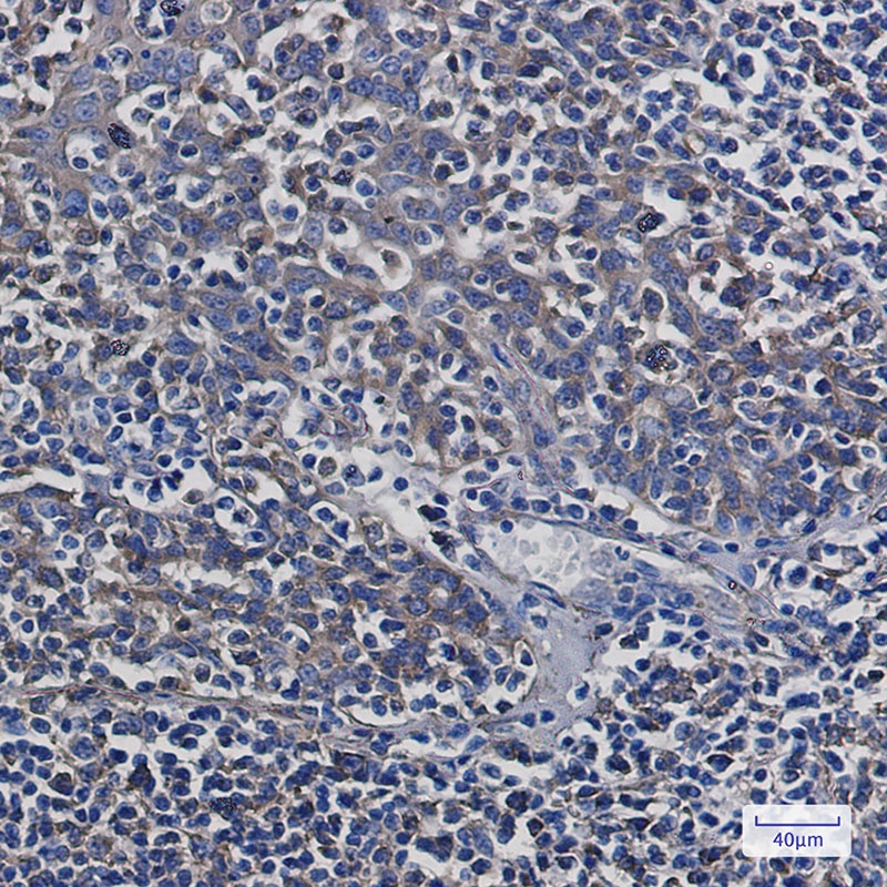 TUBB Antibody