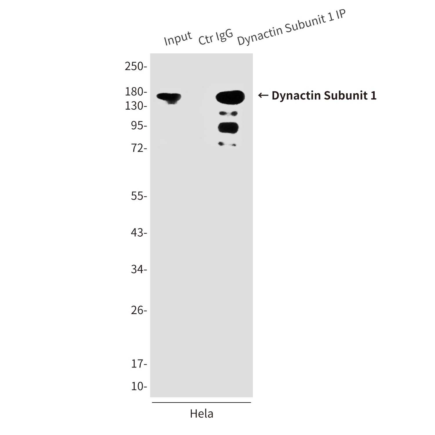 DCTN1 Antibody