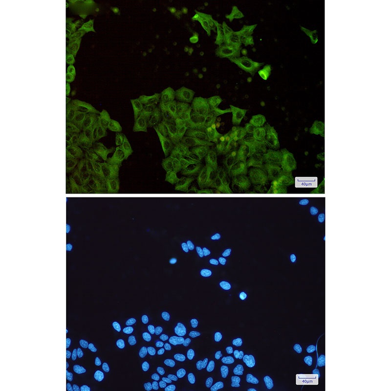 TUBB Antibody