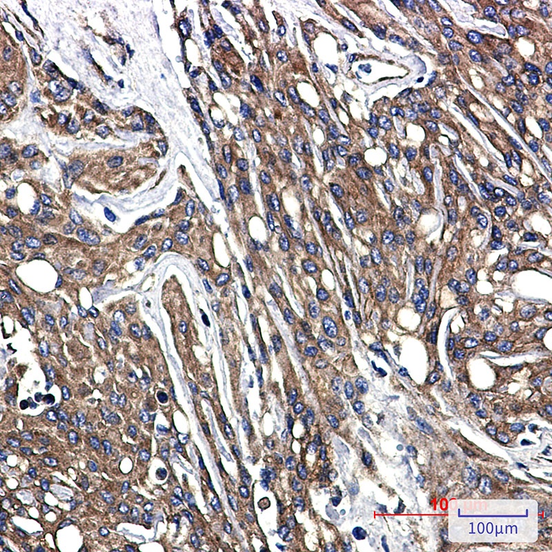 TUBB Antibody