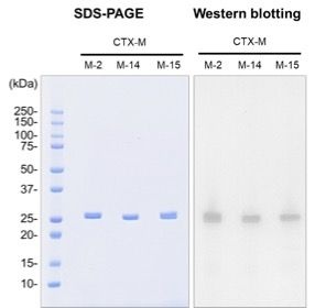 CTX-M rabbit mAb Antibody