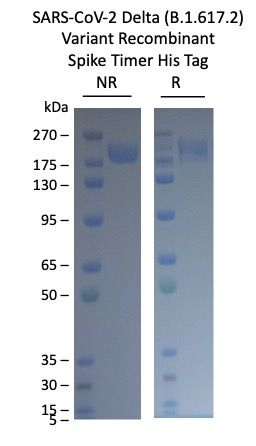 SARS-CoV-2 Delta Variant Recombinant Spike RBD His Tag-20