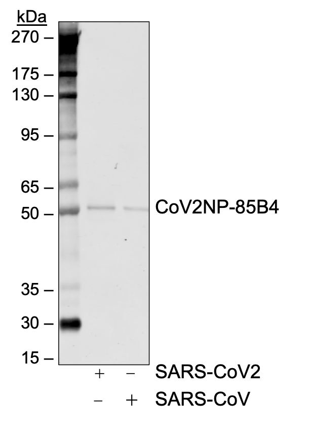 SARS-CoV-2 NP (85B4) rabbit mAb Antibody