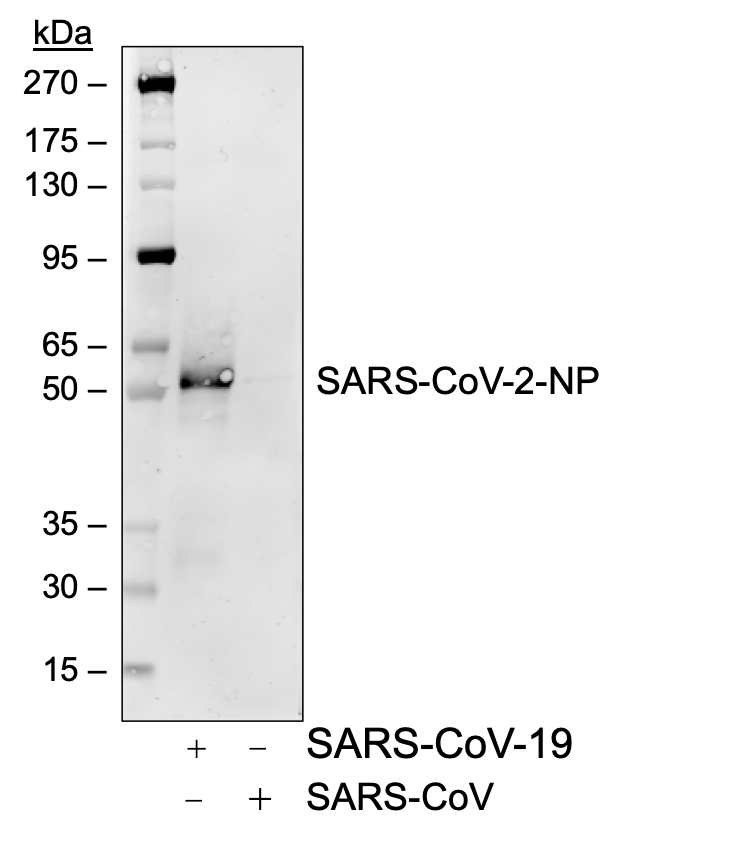 SARS-CoV-2 NP (75G5a) rabbit mAb Biotin Conjugate Antibody