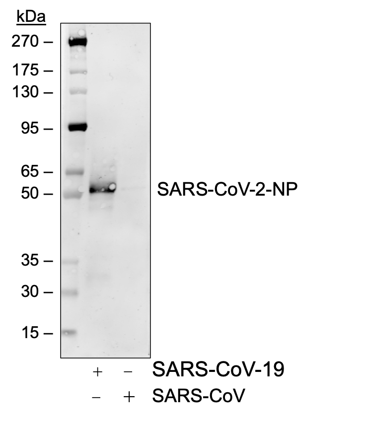 SARS-CoV-2 NP (75G5a) rabbit mAb Biotin Conjugate