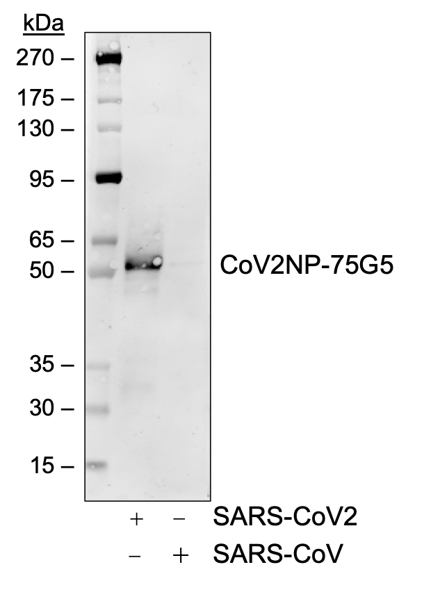SARS-CoV-2 NP (75Ga) rabbit mAb