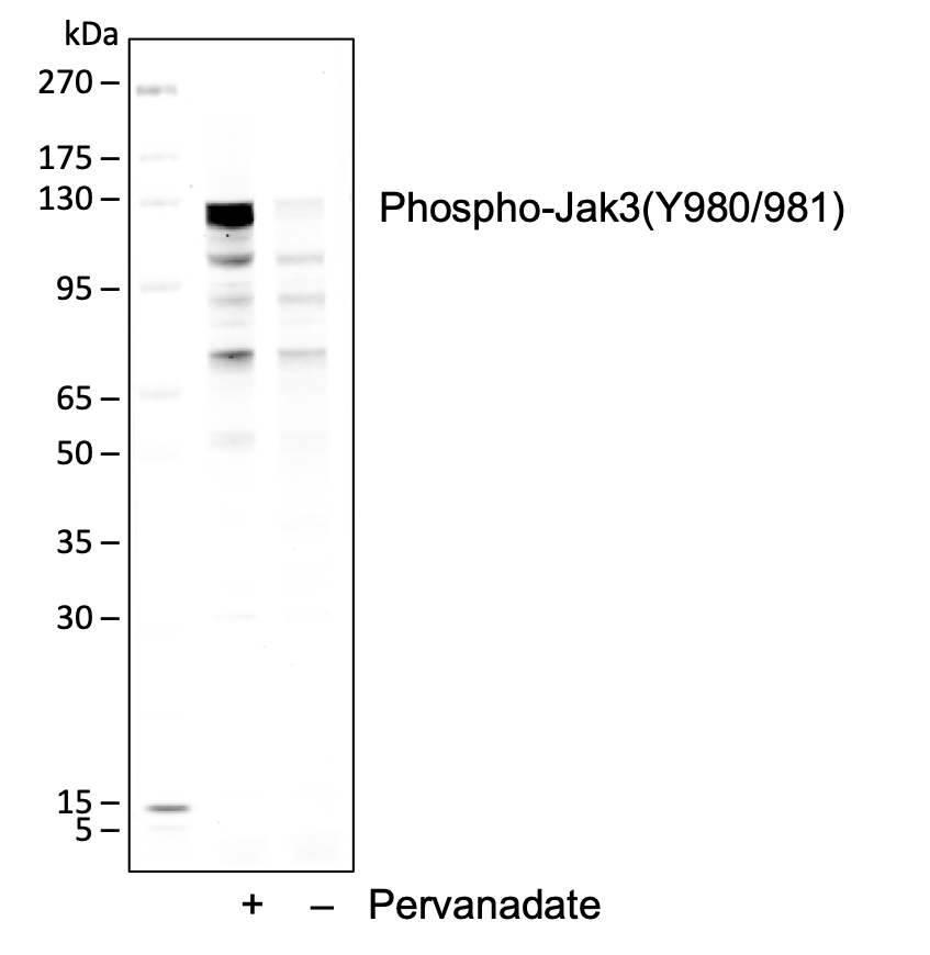Phospho-Jak3 (Tyr980/981) rabbit mAb Antibody