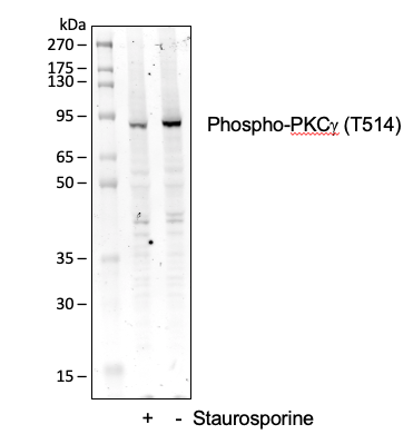 Phospho-PKC (pan) (gamma Thr514) (PF4) rabbit mAb Antibody