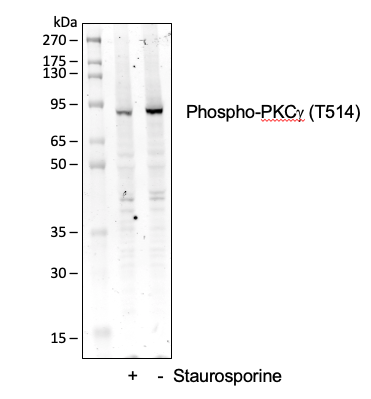 Phospho-PKC (pan) (gamma Thr514) (PF4) rabbit mAb