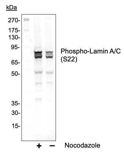 Phospho-Lamin A/C (Ser22) (CF12) rabbit mAb