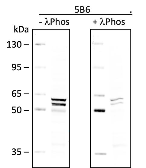 Phospho-Lyn (Tyr507) (5B6) rabbit mAb Antibody