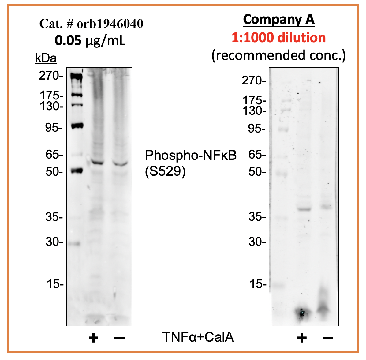 Phospho-NFkB p65 (Ser529) (A2) rabbit mAb Antibody