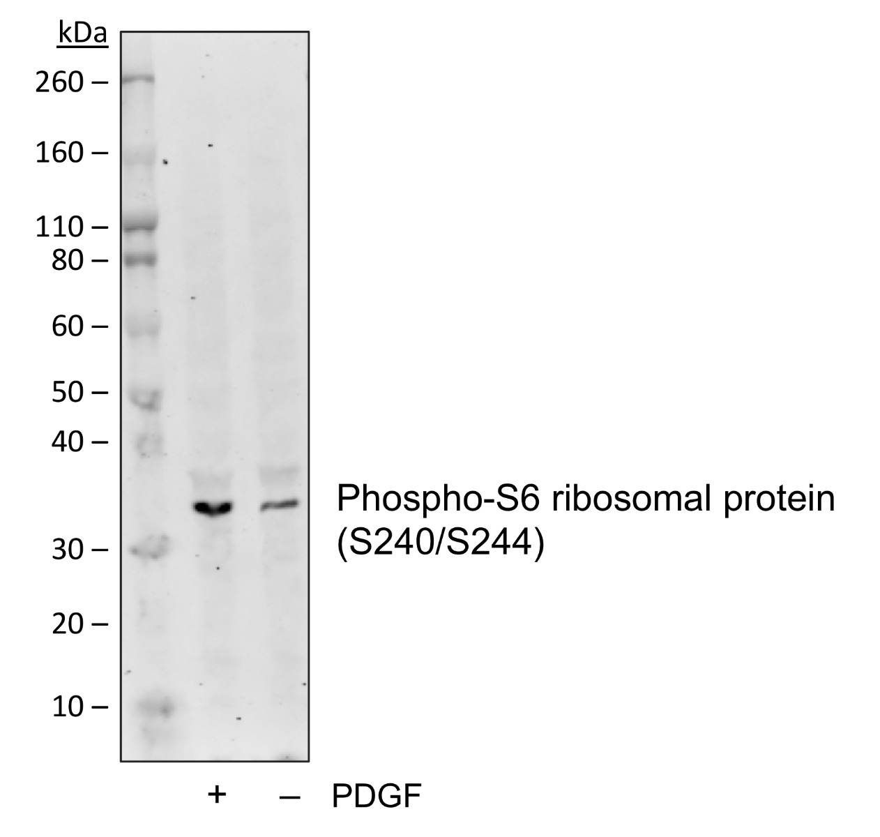 Phospho-S6-Ribosomal Protein (Ser240/244) (CD10) rabbit mAb Antibody